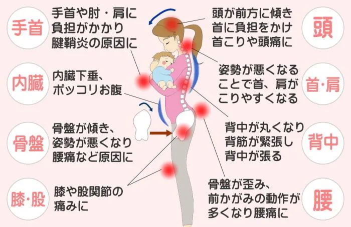 赤ちゃんのダッコに要るダメージ