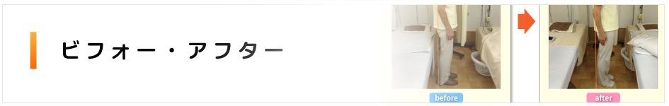 ビフォー・アフター